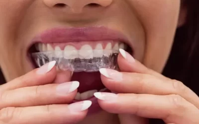 Invisalign Bridgeport: Clear Aligner Therapy for Discreet Orthodontic Correction